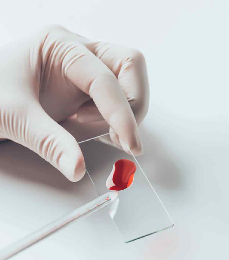 Hematología